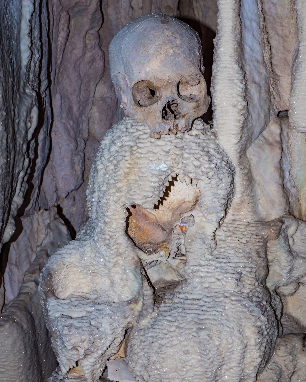 Human skull and upper bones partially encased in thick mineral deposits inside a dim cave, surrounded by rippled calcite formations and pale stone textures.